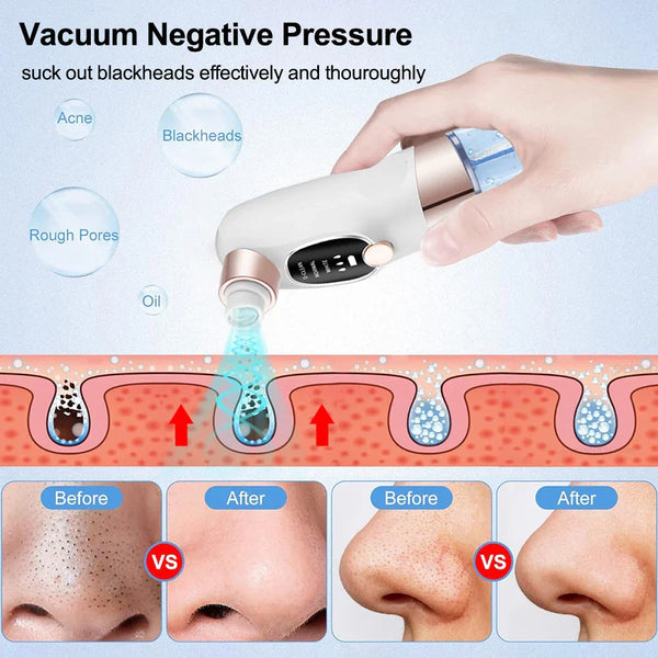 GlowClear Pore Vacuum