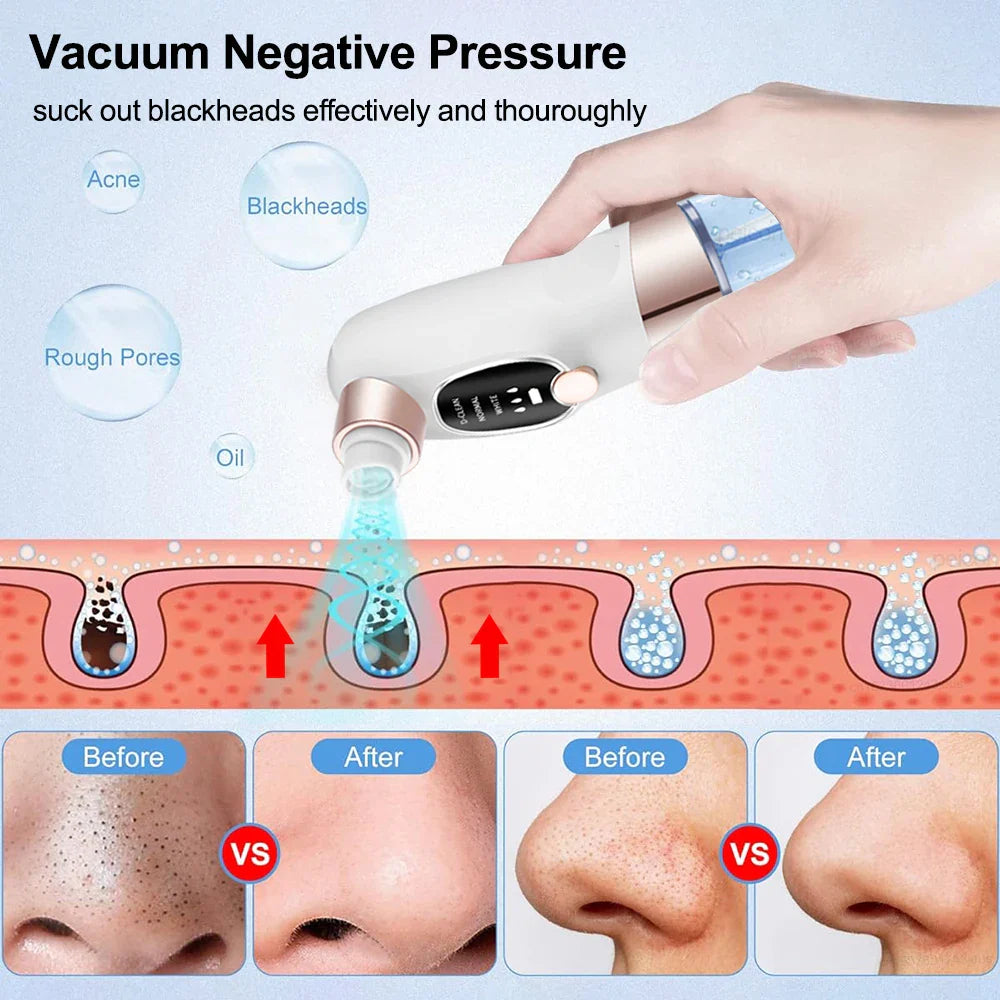 GlowClear Pore Vacuum