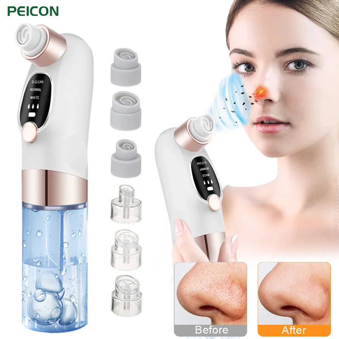 GlowClear Pore Vacuum