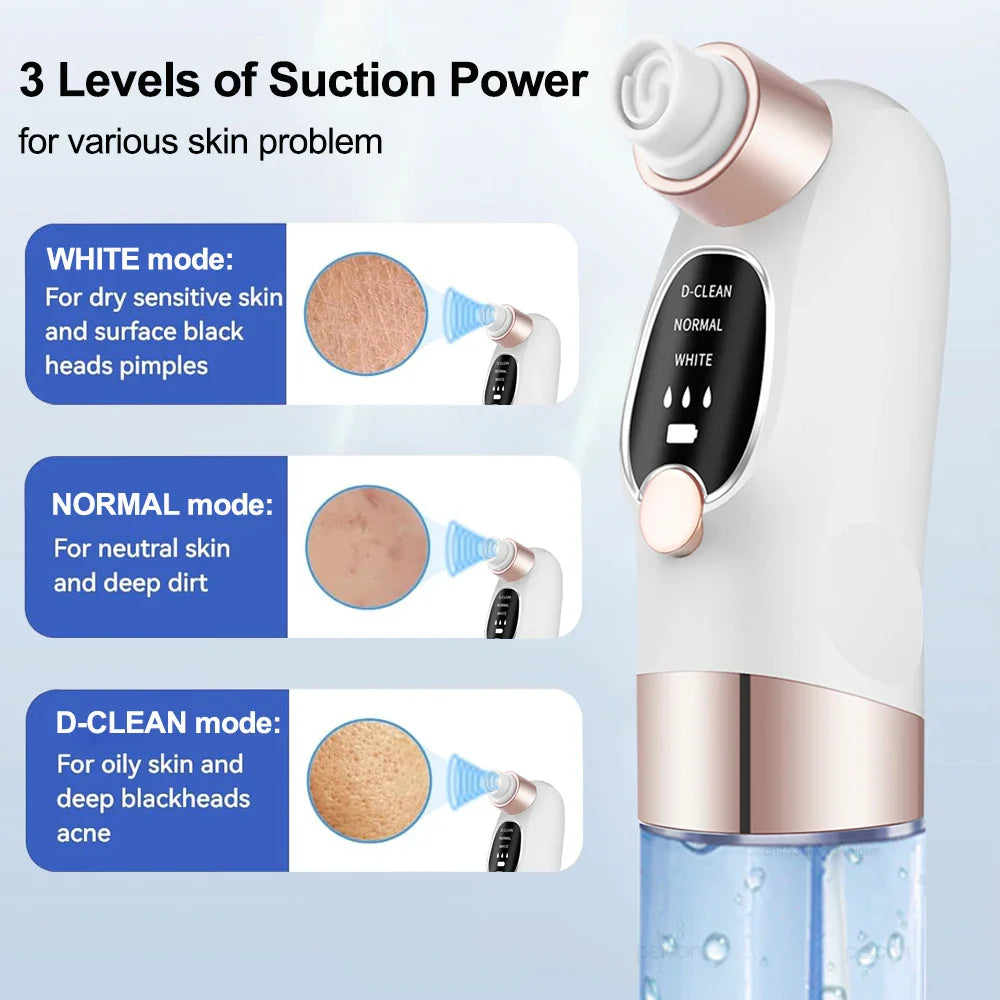 GlowClear Pore Vacuum