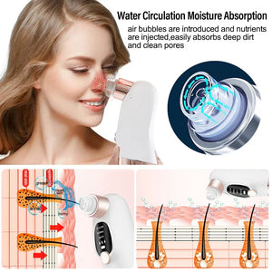 GlowClear Pore Vacuum