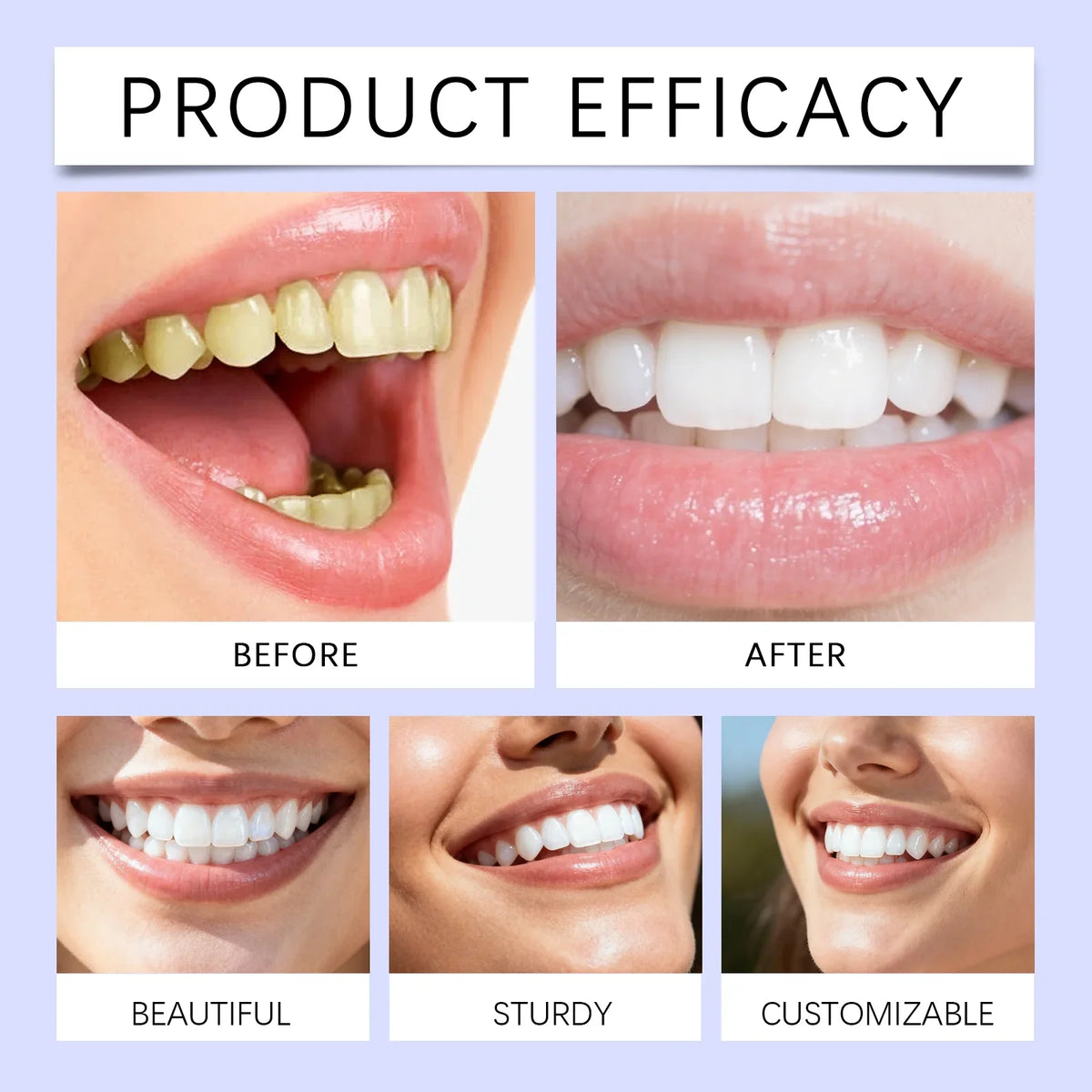 Sparkling Smile Whitening Strips
